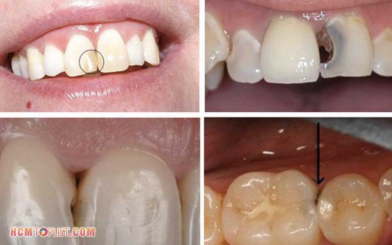 Nha-khoa-maika-hcmtoplist-1