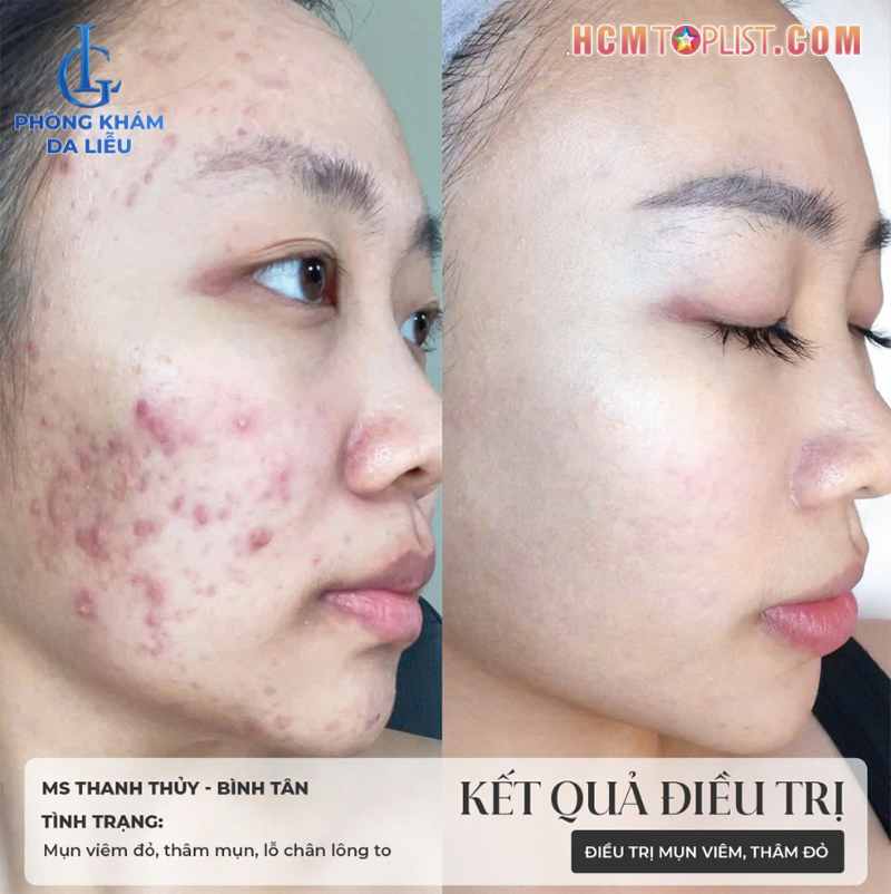 Phan-hoi-tu-khach-hang-tai-phong-kham-da-lieu-lg